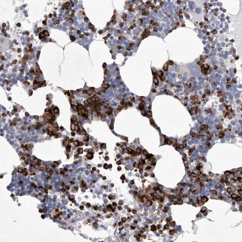Siglec-10 Antibody - BSA Free Immunohistochemistry-Paraffin: Siglec-10 Antibody [NBP1-82759]