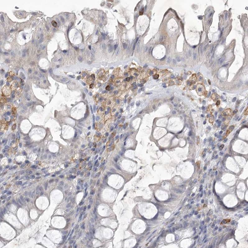 Siglec-10 Antibody - BSA Free Immunohistochemistry-Paraffin: Siglec-10 Antibody [NBP1-82759]