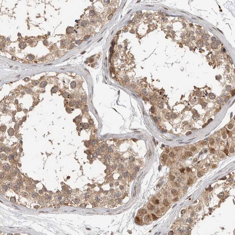 STRAP Antibody - BSA Free Immunohistochemistry-Paraffin: STRAP Antibody [NBP1-82796]