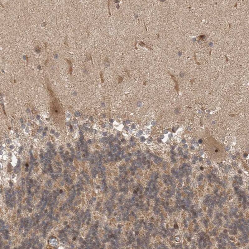 STRAP Antibody - BSA Free Immunohistochemistry-Paraffin: STRAP Antibody [NBP1-82796]