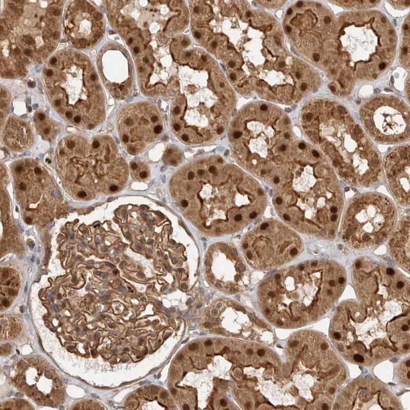 STRAP Antibody - BSA Free Immunohistochemistry-Paraffin: STRAP Antibody [NBP1-82796]