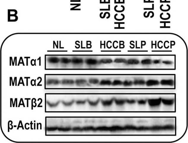 MAT2B Antibody - BSA Free