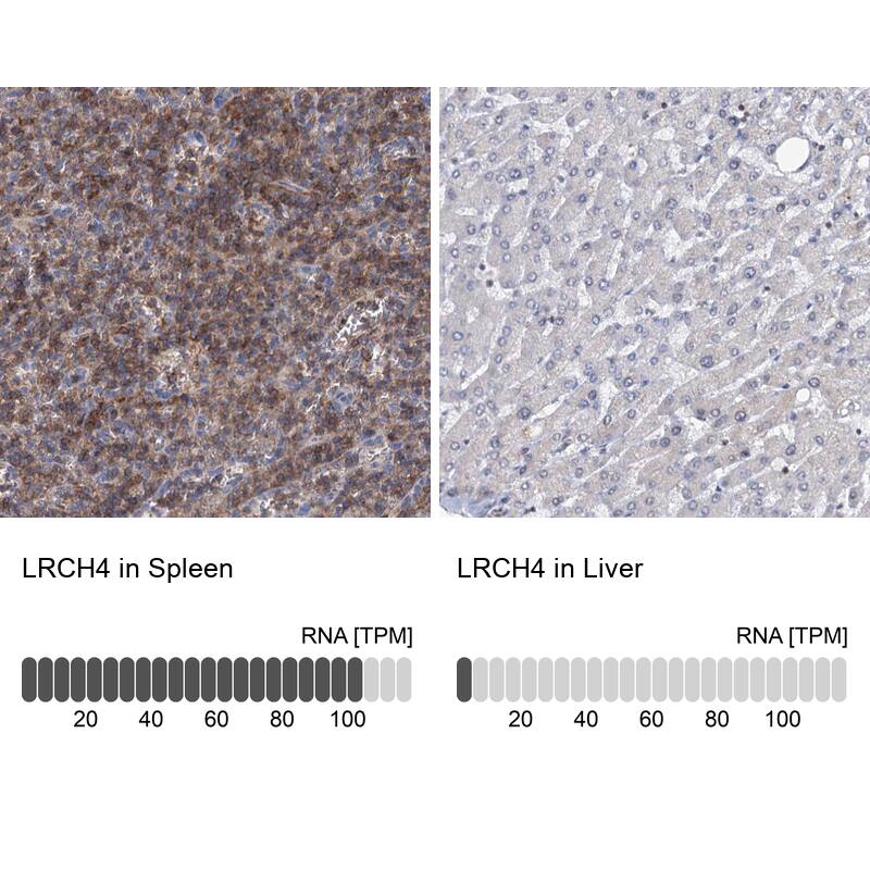 LRCH4 Antibody - BSA Free Immunohistochemistry-Paraffin: LRCH4 Antibody [NBP1-82821]