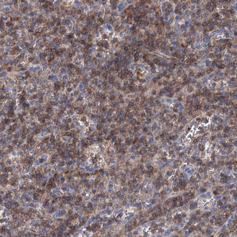 LRCH4 Antibody - BSA Free Immunohistochemistry-Paraffin: LRCH4 Antibody [NBP1-82821]