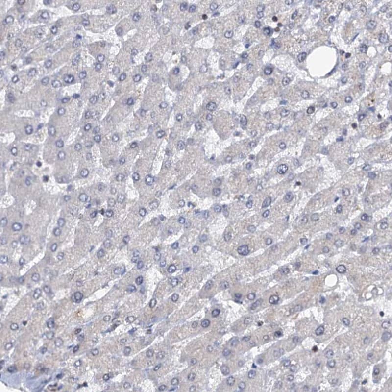 LRCH4 Antibody - BSA Free Immunohistochemistry-Paraffin: LRCH4 Antibody [NBP1-82821]