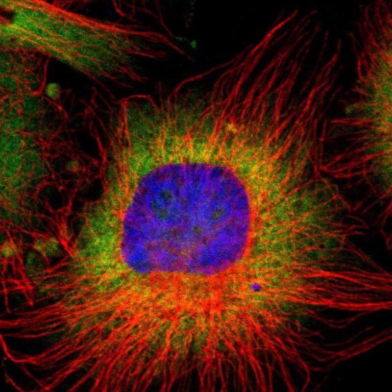 RPL9 Antibody - BSA Free Immunocytochemistry/ Immunofluorescence: RPL9 Antibody [NBP1-82853]