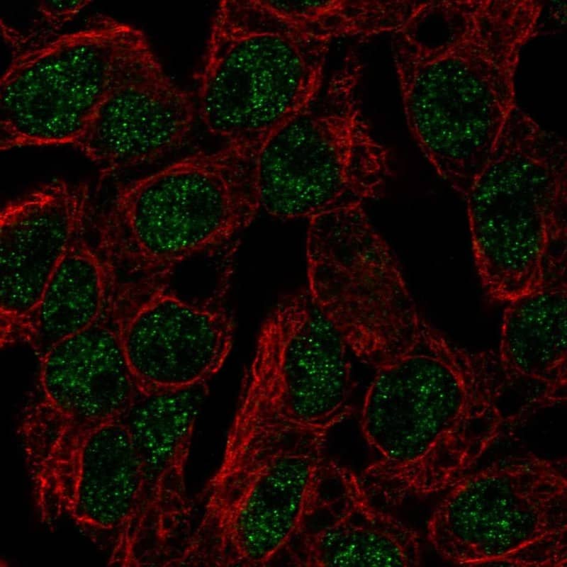SLC5A11 Antibody - BSA Free Immunocytochemistry/ Immunofluorescence: SLC5A11 Antibody [NBP1-82862]