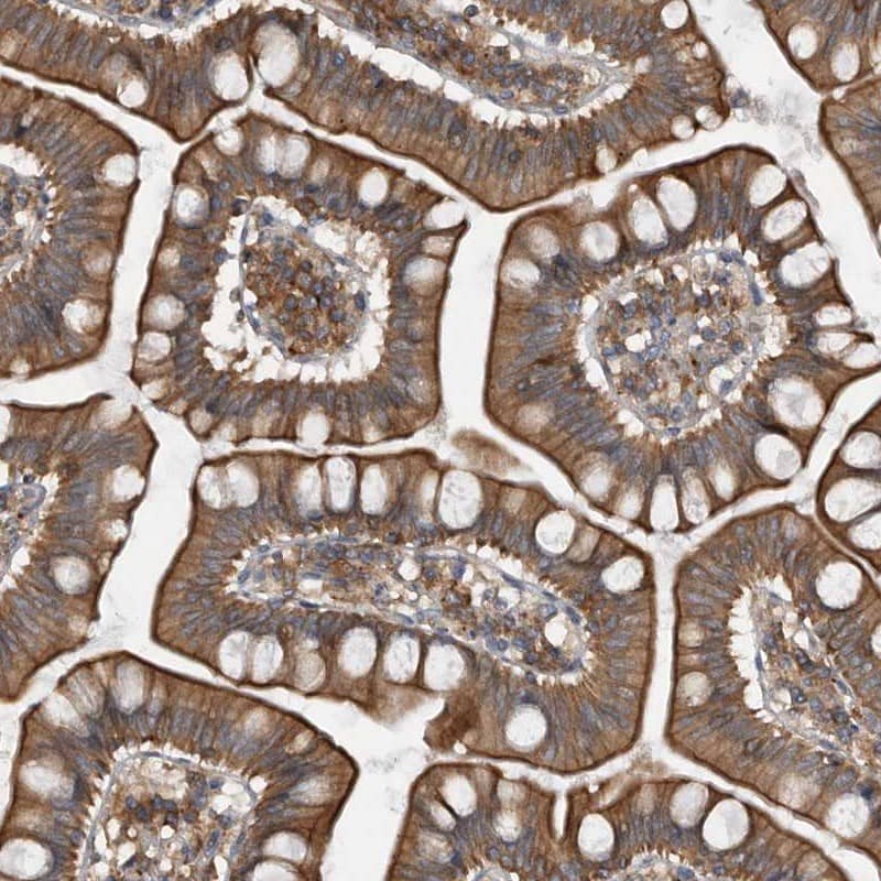 ZWINT Antibody - BSA Free Immunohistochemistry-Paraffin: ZWINT Antibody [NBP1-82868]