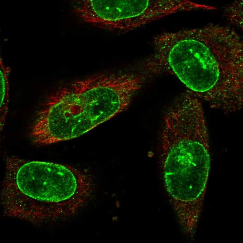 NEK1 Antibody - BSA Free Immunocytochemistry/ Immunofluorescence: NEK1 Antibody [NBP1-82883]