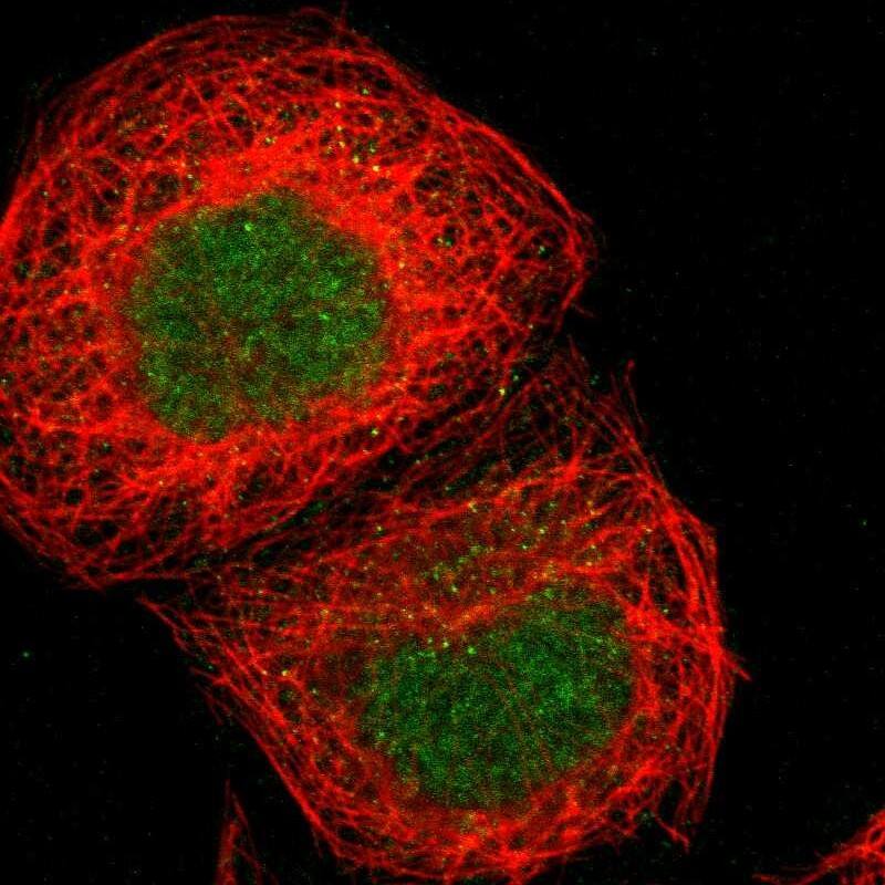 ZNF777 Antibody - BSA Free Immunocytochemistry/ Immunofluorescence: ZNF777 Antibody [NBP1-82918]
