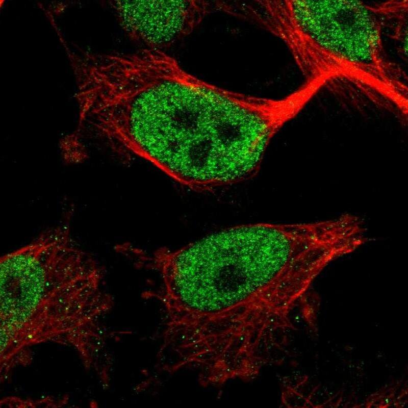 ZNF295 Antibody - BSA Free Immunocytochemistry/ Immunofluorescence: ZNF295 Antibody - BSA Free [NBP1-82923]