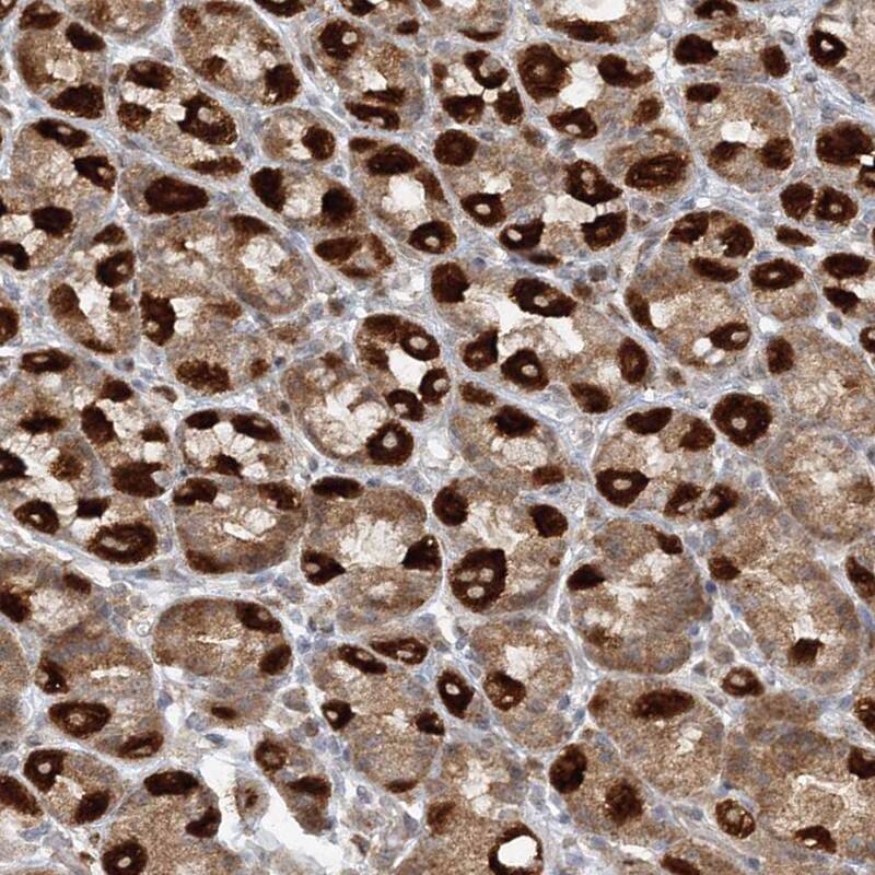 RAB11FIP2 Antibody - BSA Free Immunohistochemistry-Paraffin: RAB11FIP2 Antibody [NBP1-82949]