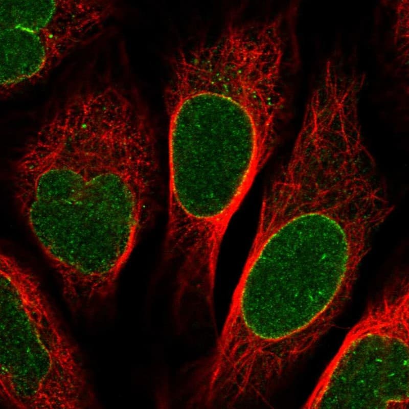 NUP155 Antibody - BSA Free Immunocytochemistry/ Immunofluorescence: NUP155 Antibody [NBP1-82960]