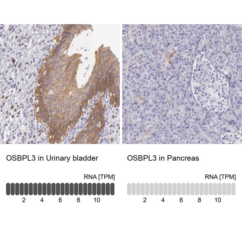 OSBPL3 Antibody - BSA Free Immunohistochemistry-Paraffin: OSBPL3 Antibody [NBP1-82968]