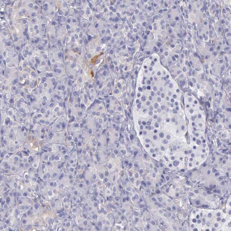 OSBPL3 Antibody - BSA Free Immunohistochemistry-Paraffin: OSBPL3 Antibody [NBP1-82968]