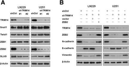 ZEB2 Antibody