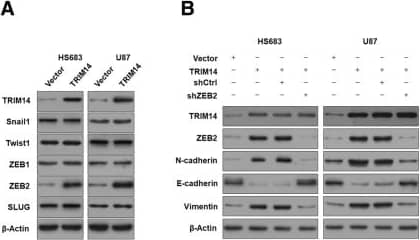 ZEB2 Antibody