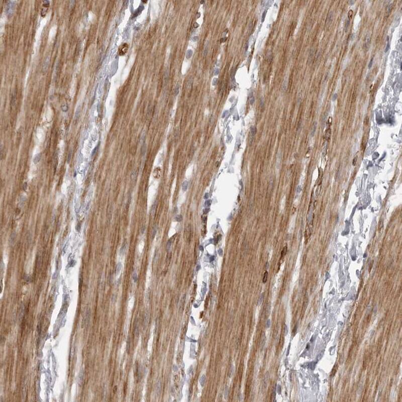 ZCCHC11/TUT4 Antibody - BSA Free Immunohistochemistry-Paraffin: ZCCHC11/TUT4 Antibody [NBP1-83027]