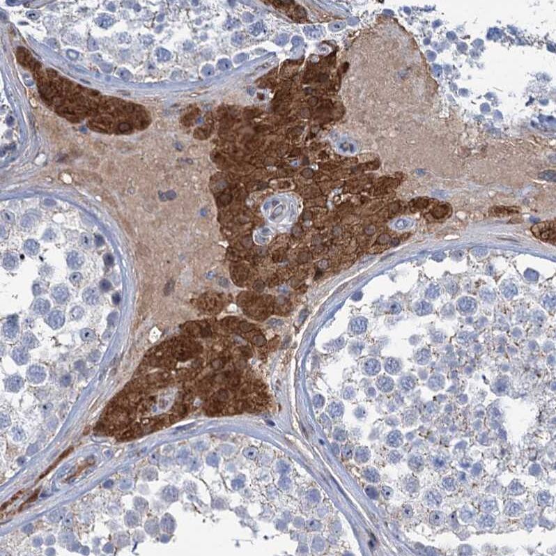 Lipin 1 Antibody - BSA Free Immunohistochemistry-Paraffin: Lipin 1 Antibody [NBP1-83030]