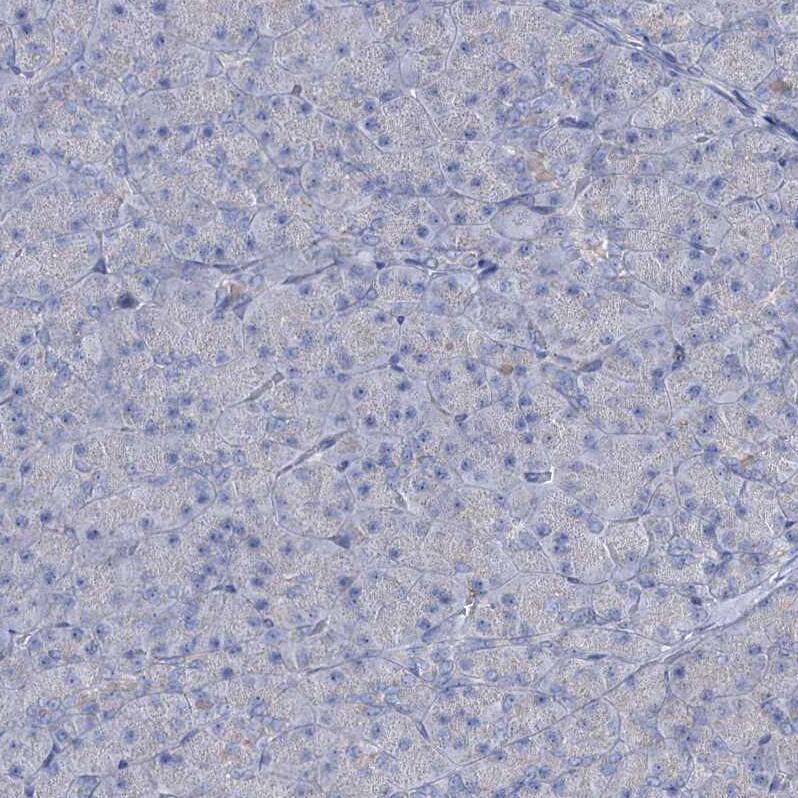 Lipin 1 Antibody - BSA Free Immunohistochemistry-Paraffin: Lipin 1 Antibody [NBP1-83030]