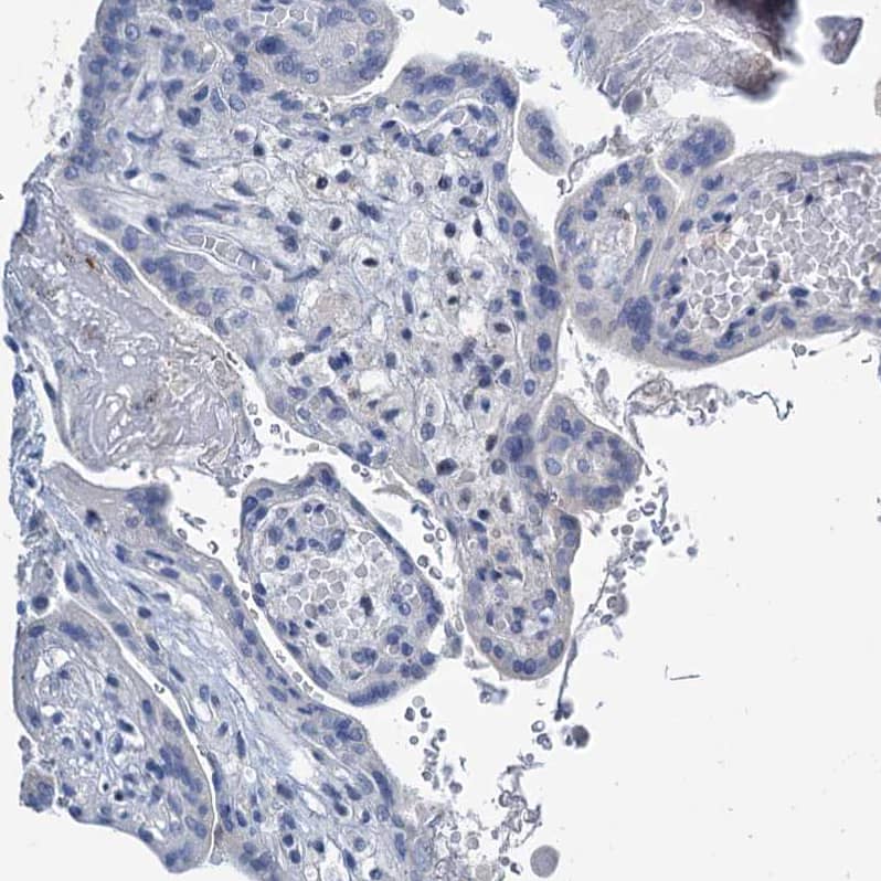 Lipin 1 Antibody - BSA Free Immunohistochemistry-Paraffin: Lipin 1 Antibody [NBP1-83030]