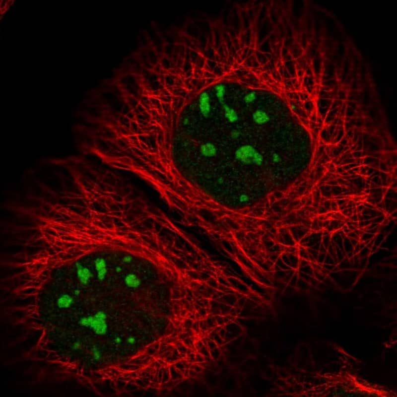 RBM34 Antibody - BSA Free Immunocytochemistry/ Immunofluorescence: RBM34 Antibody [NBP1-83039]