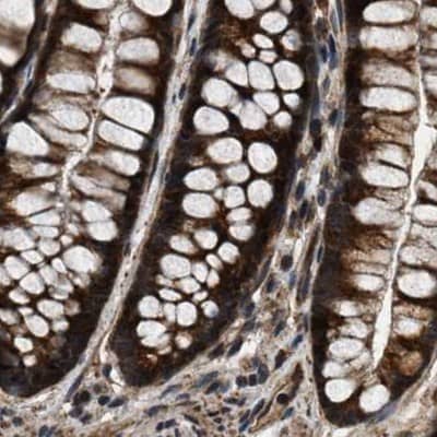 PPWD1 Antibody - BSA Free Immunohistochemistry-Paraffin: PPWD1 Antibody [NBP1-83050]