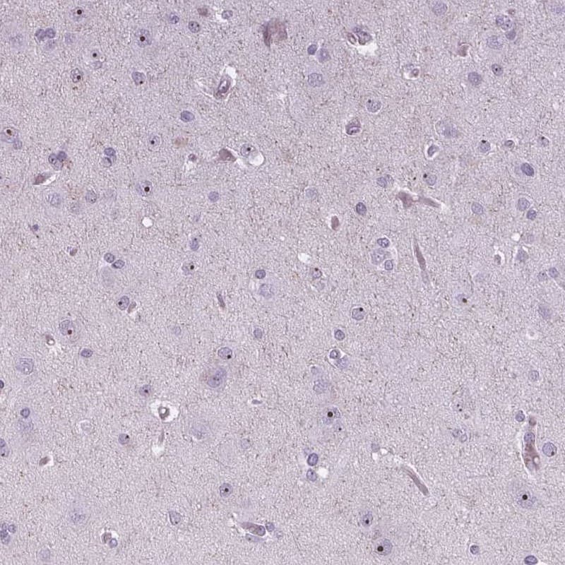 NOLC1 Antibody - BSA Free Immunohistochemistry-Paraffin: NOLC1 Antibody [NBP1-83058]