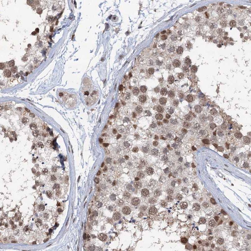PHF8 Antibody - BSA Free Immunohistochemistry-Paraffin: PHF8 Antibody [NBP1-83079]