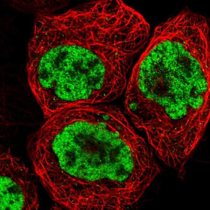 FoxK1 Antibody - BSA Free Immunocytochemistry/ Immunofluorescence: FoxK1 Antibody [NBP1-83110]