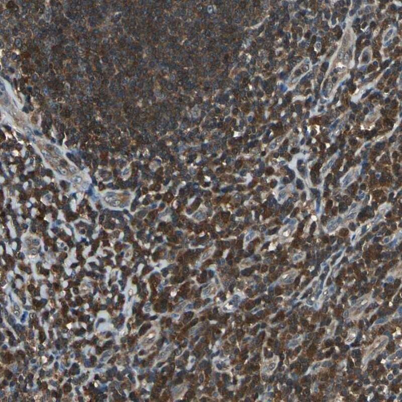 PA28 Activator alpha Subunit/PSME1 Antibody - BSA Free Immunohistochemistry-Paraffin: PA28 Activator alpha Subunit/PSME1 Antibody [NBP1-83121]