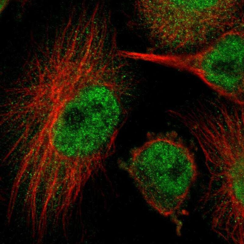 HUWE1 Antibody - BSA Free Immunocytochemistry/ Immunofluorescence: HUWE1 Antibody [NBP1-83127]