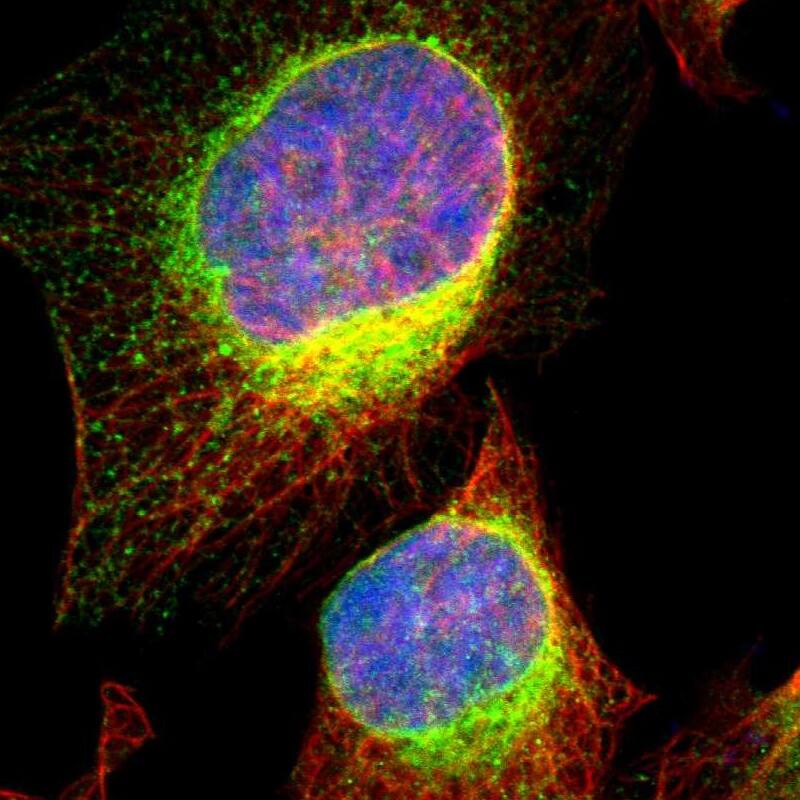 VAP-A Antibody - BSA Free Immunocytochemistry/ Immunofluorescence: VAP-A Antibody [NBP1-83132]