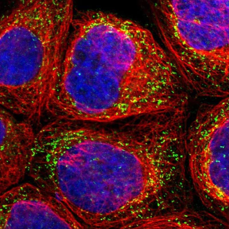 PECR Antibody - BSA Free Immunocytochemistry/ Immunofluorescence: PECR Antibody [NBP1-83198]