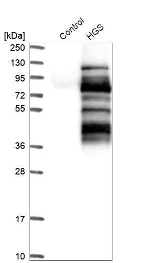 HGS Antibody - BSA Free Western Blot: HGS Antibody - BSA Free [NBP1-83202]
