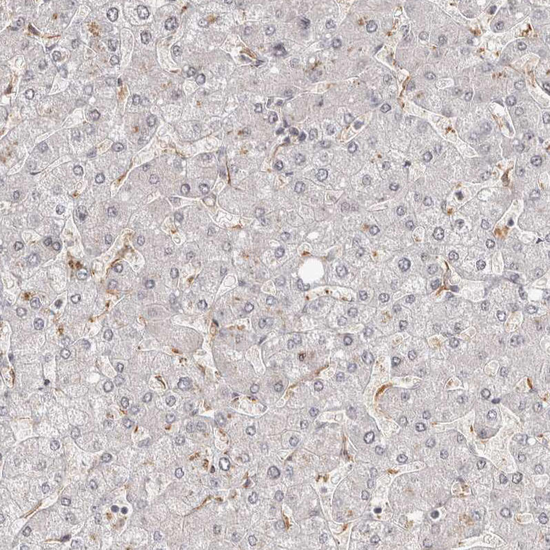 ZNF318 Antibody - BSA Free Immunohistochemistry-Paraffin: ZNF318 Antibody - BSA Free [NBP1-83208]