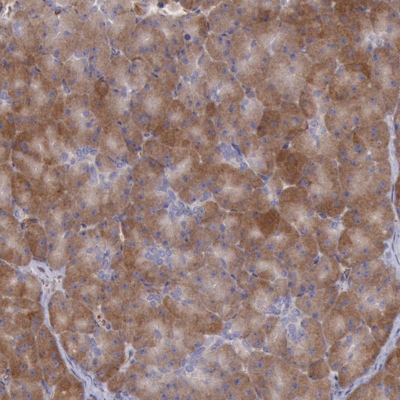 RNF139 Antibody - BSA Free Immunohistochemistry-Paraffin: RNF139 Antibody - BSA Free [NBP1-83212]