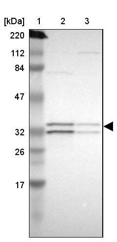 ECH1 Antibody - BSA Free Western Blot: ECH1 Antibody - BSA Free [NBP1-83215]