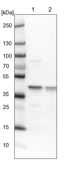ECH1 Antibody - BSA Free Western Blot: ECH1 Antibody - BSA Free [NBP1-83215]