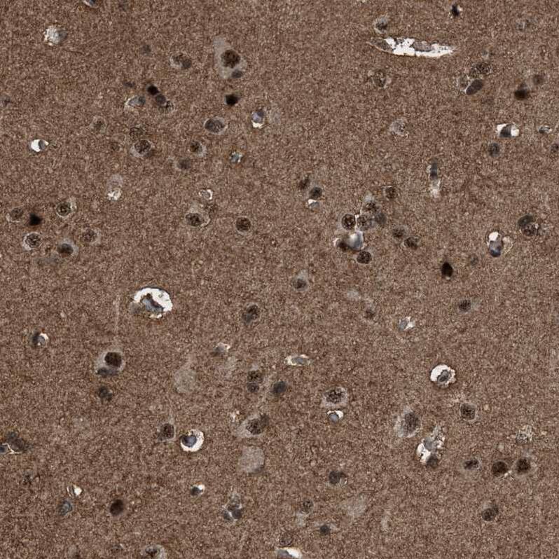 PRPF4 Antibody - BSA Free Immunohistochemistry-Paraffin: PRPF4 Antibody - BSA Free [NBP1-83218]