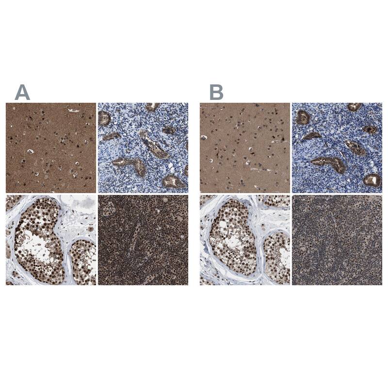 PRPF4 Antibody - BSA Free Immunohistochemistry-Paraffin: PRPF4 Antibody - BSA Free [NBP1-83218]