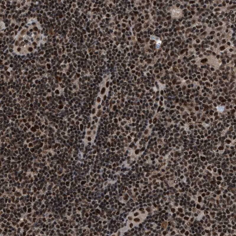 PRPF4 Antibody - BSA Free Immunohistochemistry-Paraffin: PRPF4 Antibody - BSA Free [NBP1-83218]
