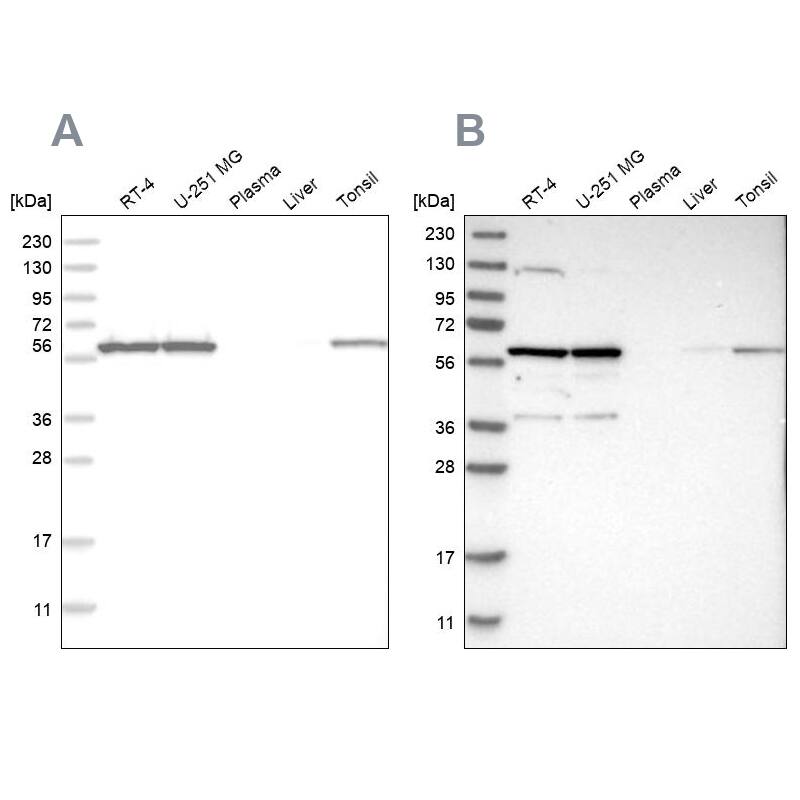 PRPF4 Antibody - BSA Free Western Blot: PRPF4 Antibody - BSA Free [NBP1-83218]