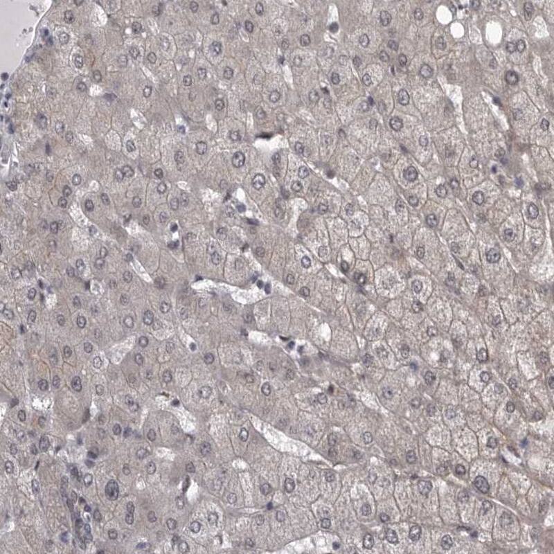 PRPF3 Antibody - BSA Free Immunohistochemistry-Paraffin: PRPF3 Antibody - BSA Free [NBP1-83219]