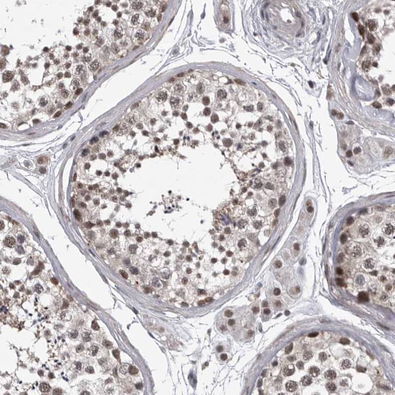 PRPF3 Antibody - BSA Free Immunohistochemistry-Paraffin: PRPF3 Antibody - BSA Free [NBP1-83219]