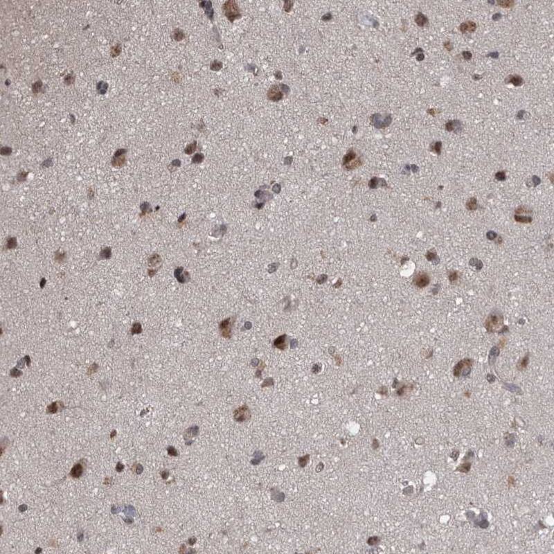 PRPF3 Antibody - BSA Free Immunohistochemistry-Paraffin: PRPF3 Antibody - BSA Free [NBP1-83219]