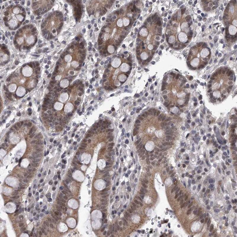 PRPF3 Antibody - BSA Free Immunohistochemistry-Paraffin: PRPF3 Antibody - BSA Free [NBP1-83219]