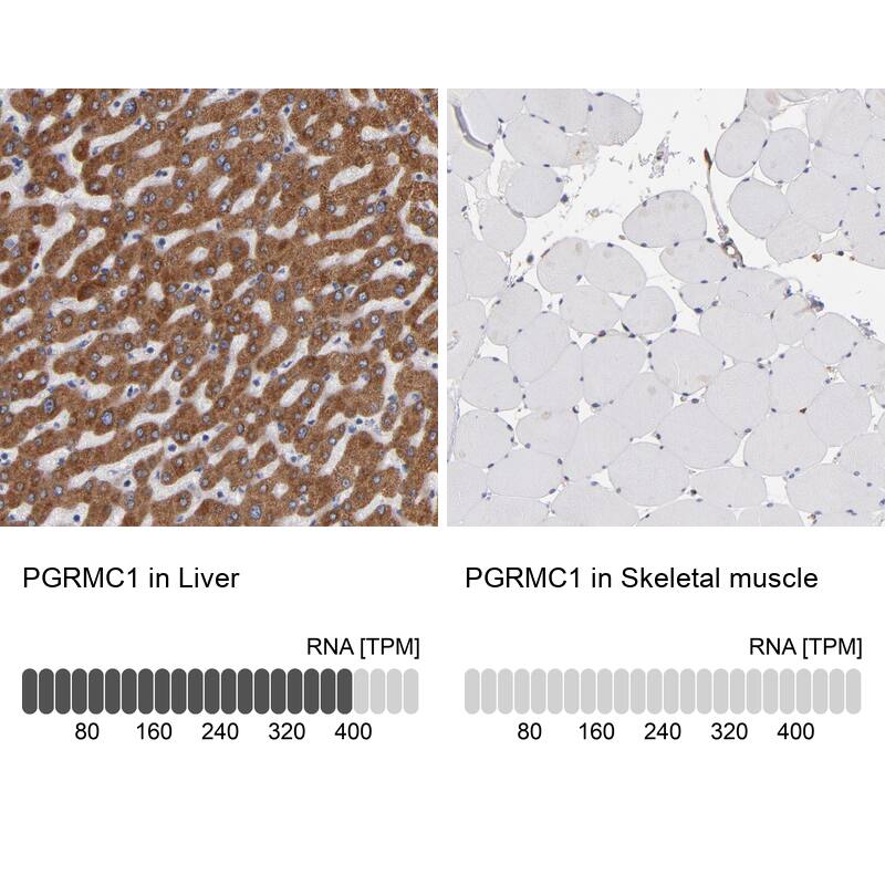 PGRMC1 Antibody - BSA Free Immunohistochemistry-Paraffin: PGRMC1 Antibody - BSA Free [NBP1-83220]