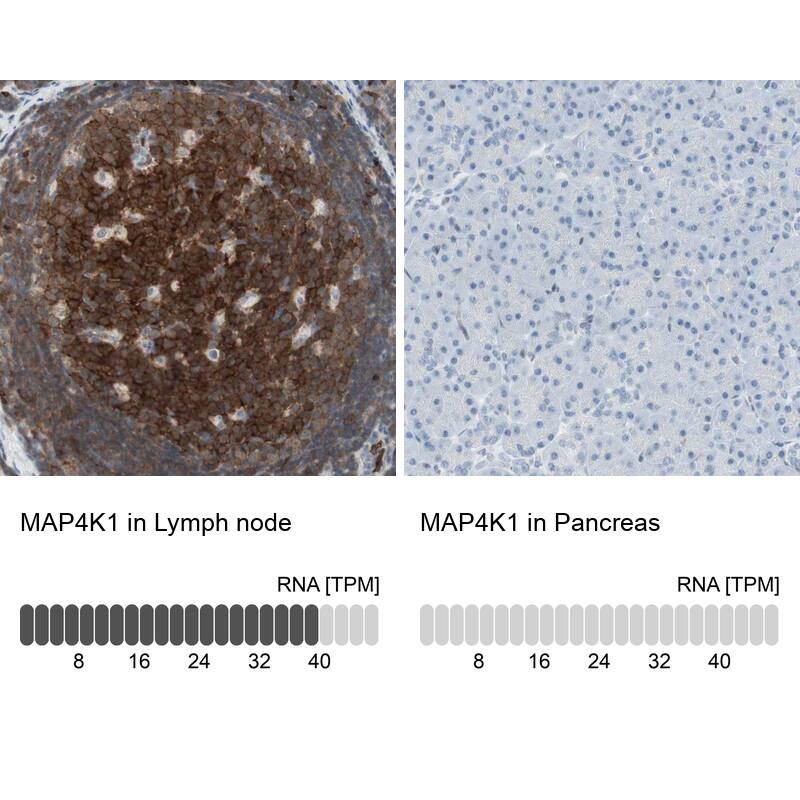 MAP4K1 Antibody - BSA Free Immunohistochemistry-Paraffin: MAP4K1 Antibody - BSA Free [NBP1-83221]