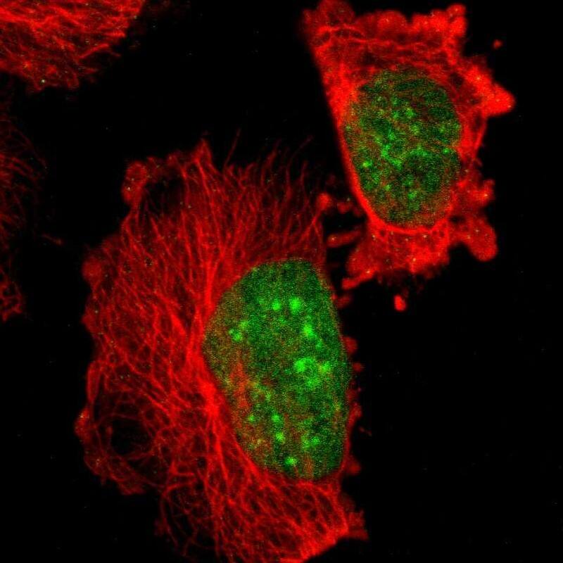 CBX3 Antibody - BSA Free Immunocytochemistry/ Immunofluorescence: CBX3 Antibody [NBP1-83228]